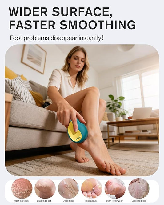 BEZOX Glass Foot Scrubber – Professional Foot File Callus Remover for Dead Skin & Cracked Heels – Premium Pumice Stone Pedicure Tools for Feet with Anti-Slip Handle and Protective Cover - Green