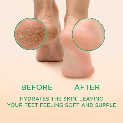 Lee Beauty 8oz Professional Gel Callus Remover for Feet - Peppermint Fast-Acting Formula, Extra Strength for Cracked Heels & Dead Skin (Pack of 1)