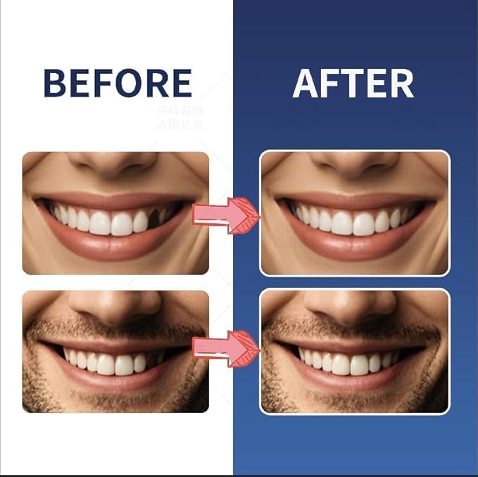 Tooth Repair Kit，Temporary Natural Shade for Filling The Gap, Moldable Thermal Beads Replacement Kit Replace The Missing or Broken Tooth-6PCS-TK05