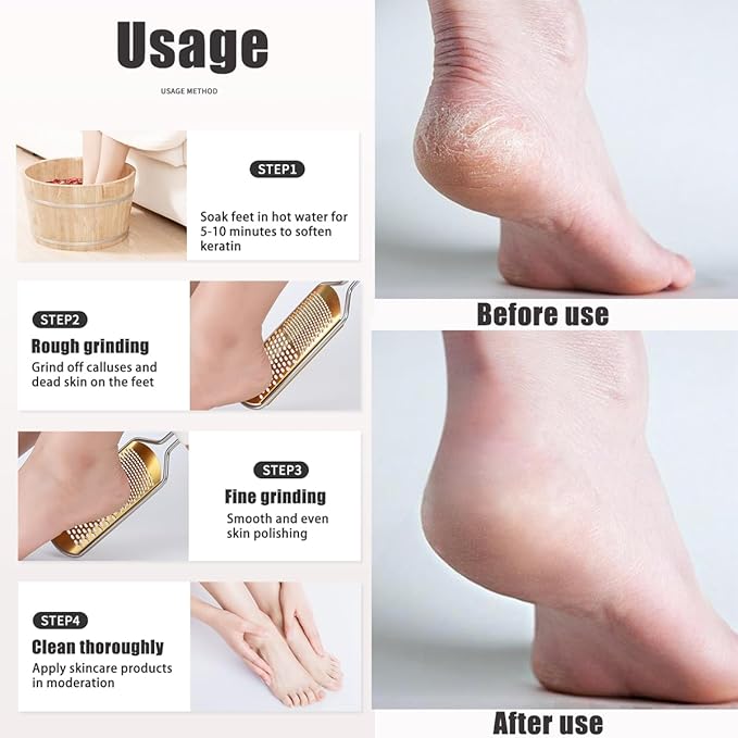 White Foot File & Callus Remover – Professional Pedicure Tool for Dead Skin Removal, Cracked Heels & Smooth Feet – Ultimate Stainless Steel Foot Scrubber for Soft, Healthy Feet (White A)