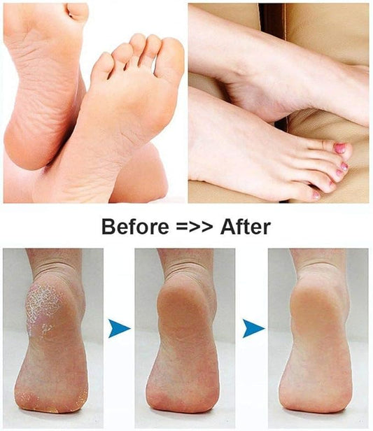 Foot Scrubber Electric Callus Remover Rechargeable Foot File Hard Skin Remover Pedicure Tools Electronic Callus kit for Cracked Heels and Dead Skin with 2 Roller Heads