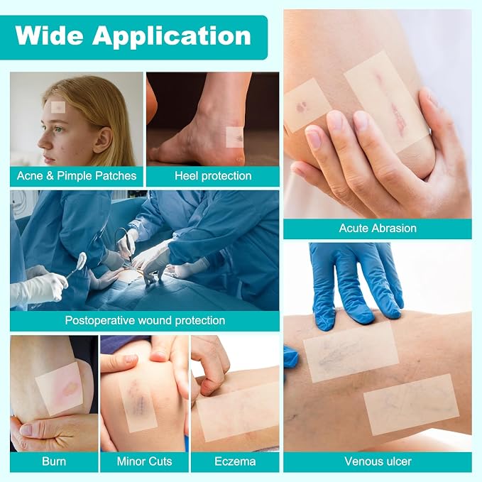 Hydrocolloid Roll for Wound Care, Hydrocolloid Bandages with Self-Adhesive, Cut-to-Size Patch Bandages, Ultra Absorbent, Waterproof, First Aid Kit Essential (2IN*16FT)