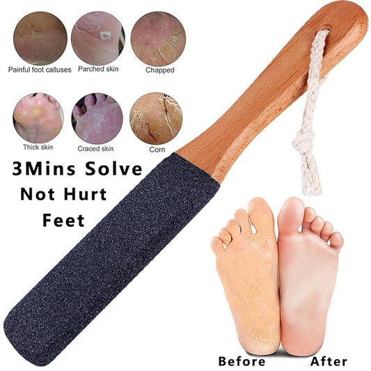 Kinepi Foot File Callus Remover for Feet,Pumice Stone for Feet with Handle,Foot Scrubber and Pedicure Foot Rasp for Cracked Heels, Dead Skin and Hard Skin,Wet and Dry Feet