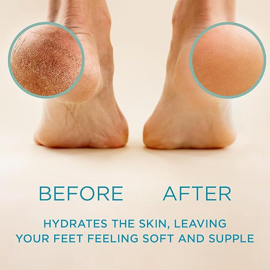 Lee Beauty 8oz Professional Gel Callus Remover for Feet - Original Fast-Acting Formula, Extra Strength for Cracked Heels & Dead Skin (Pack of 2)