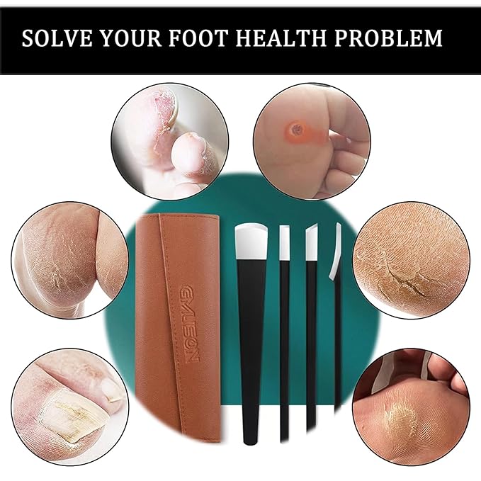 Professional Pedicure Knife Set Callus Knife for Feet Ingrown Toenail Knives Foot Care Tools Dead Skin Removal Nail Scraper File