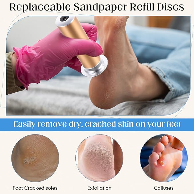 Gisafai 1000 Pcs Replaceable Sandpaper Refill Discs Bulk 180 Grit Replacement Sandpaper Pad Discs for Electric Foot File Callus Remover Black Tool Foot File Disks for Cracked Heels Dead Skin