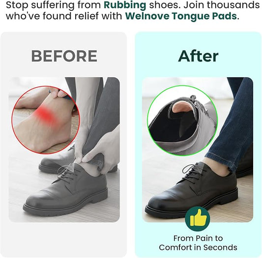 Welnove Tongue Pads Inserts for Shoes - Tow Size in One Pack - 16 Pcs Shoe Padding Cushion Soft Self Adhesive Inserts Filler for Boots, Leather Shoes, Dress Shoes, Loafers - Size S & L