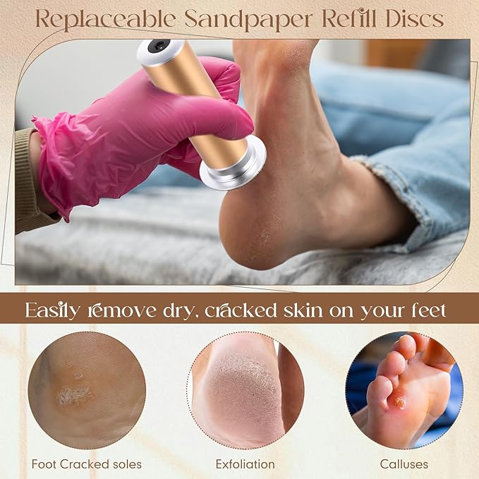 Gisafai 1000 Pcs Replaceable Sandpaper Refill Discs Bulk 100 Grit Replacement Sandpaper Pad Discs for Electric Foot File Callus Remover Black Tool Foot File Disks for Men Women Cracked Heels Dead Skin