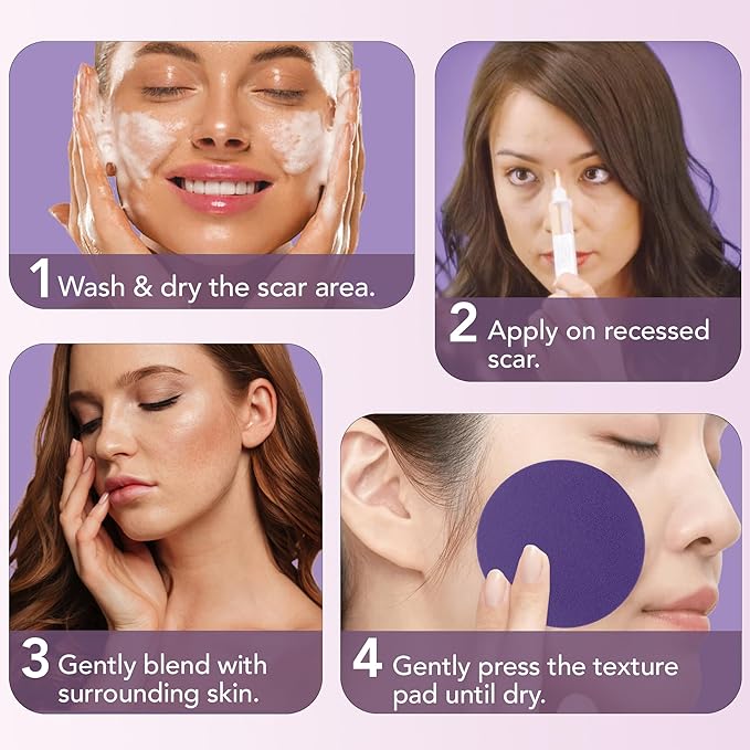 Dermaflage Scar Filler Kit - Medium - Deep Scar Cover and Waterproof Concealer for Acne Scars Wrinkles, and Ice Pick Scars Makeup, 1 mo supply