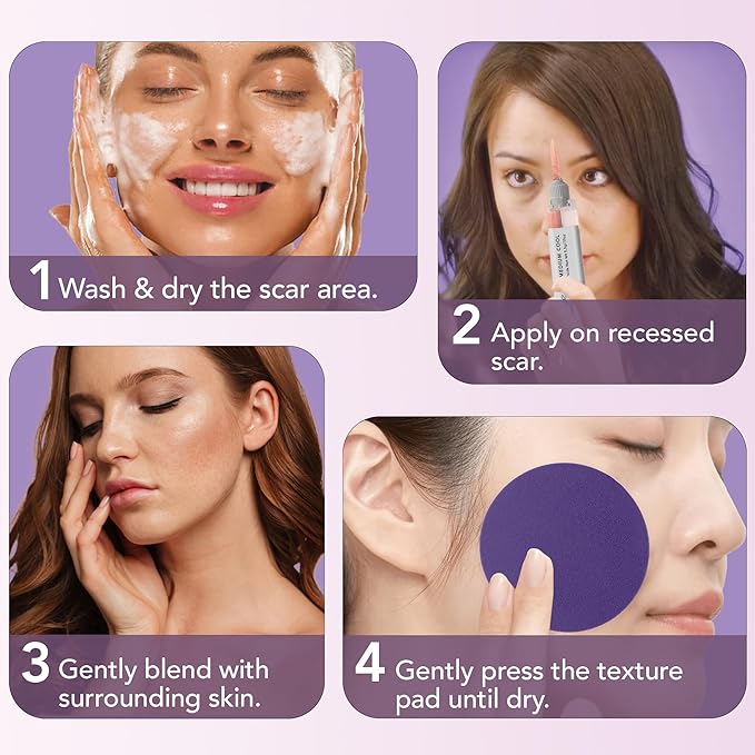 Dermaflage Scar Filler Kit - Medium Cool - Deep Scar Cover and Waterproof Concealer for Acne Scars Wrinkles, and Ice Pick Scars Makeup, 1 mo supply
